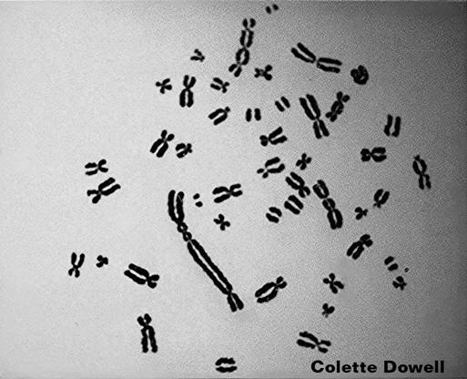 Genetically Damaged Chromosomes Radiation Fukushima Chernobyl Nucllear Radiaoctive fallout  Iraq Depleted Uranium Nuclear Energy Radioactive